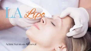 Woman receiving Actinic Keratosis Removal Treatment Banstead