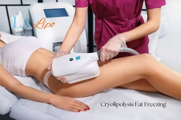 Woman receiving coolsculpting Banstead treatment on her thighs