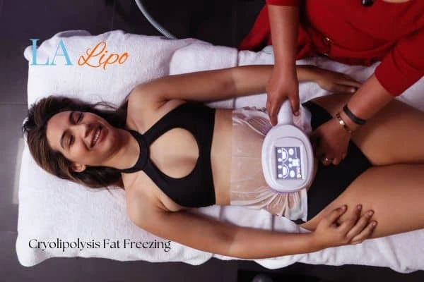 woman getting cryolipolysis Banstead