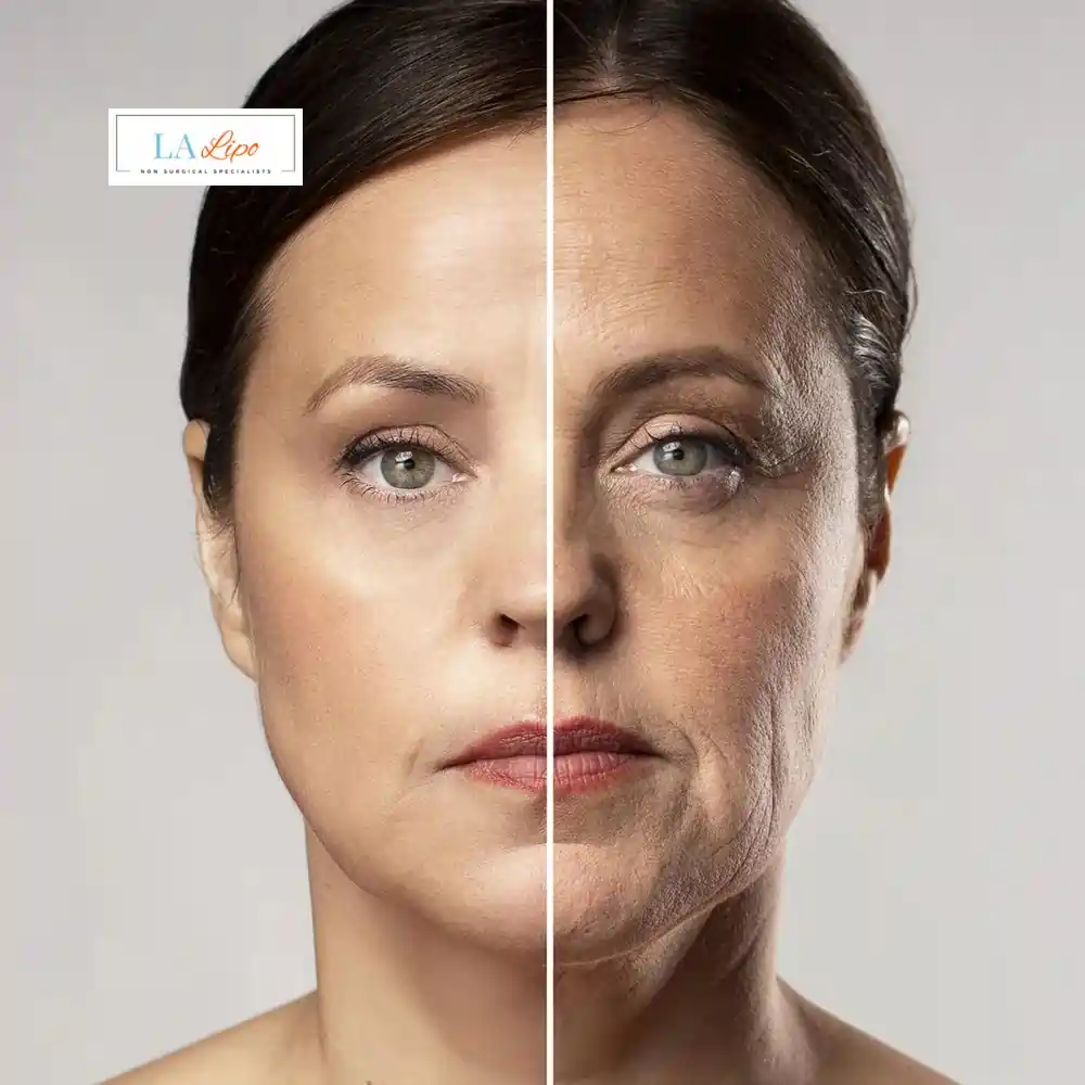 How Can You Tell If Non-Surgical Skin Tightening Is Right for You Banstead?